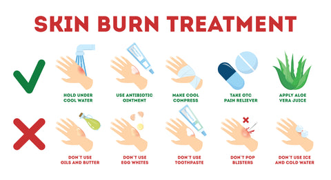 How To Properly Treat A Burn Mountainside Medical Equipment