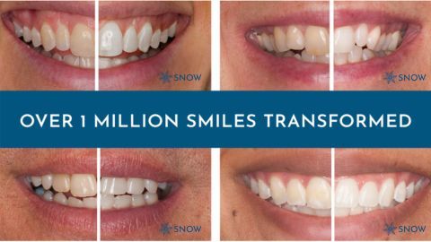 Snow Teeth Whitening Kit Strips Gels Toothpaste 25k Reviews