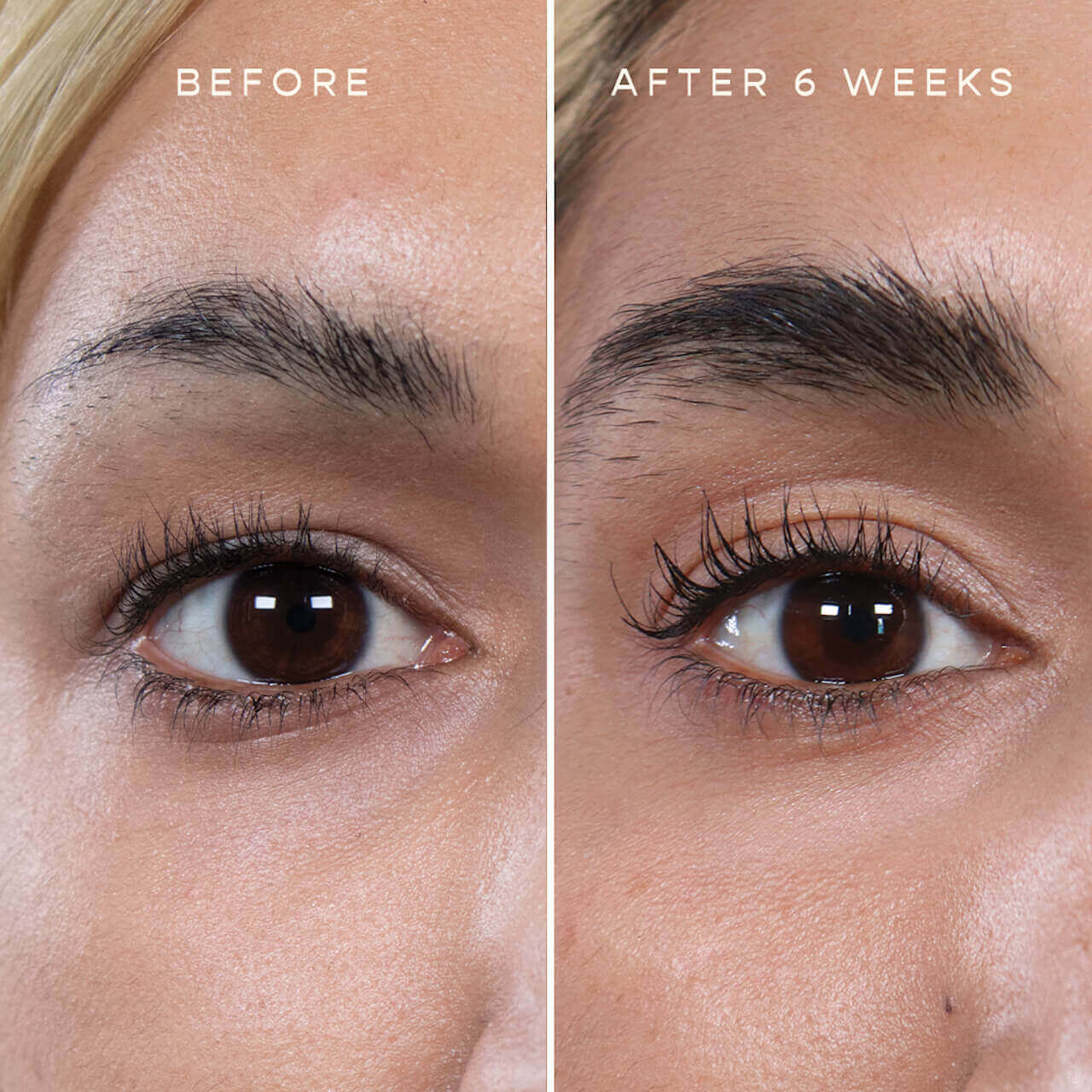 Top 5 Tips If You Re Losing Your Eyebrows
