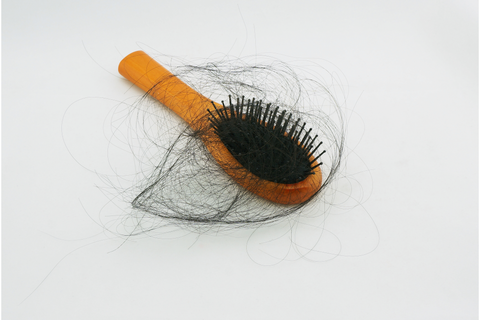 Does Anemia Cause Hair Loss Here S All You Need To Know