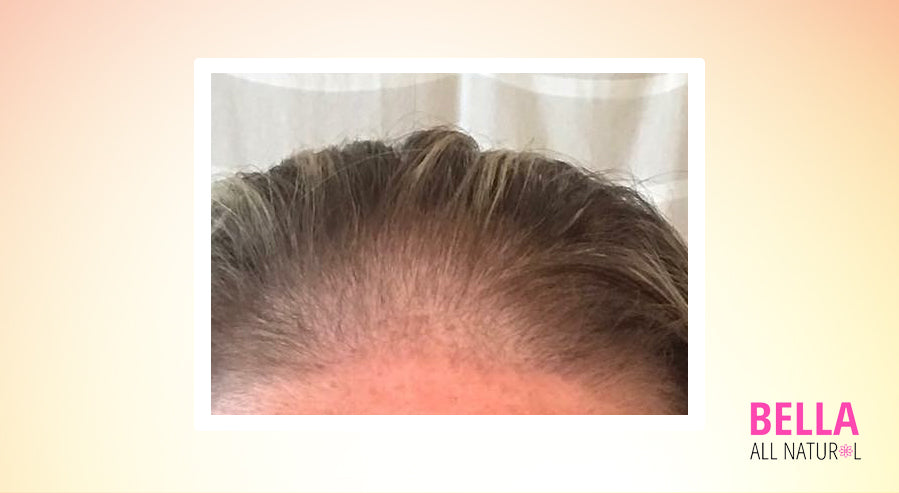 15 Easy Home Remedies For Repairing Damaged Hair Bella All Natural