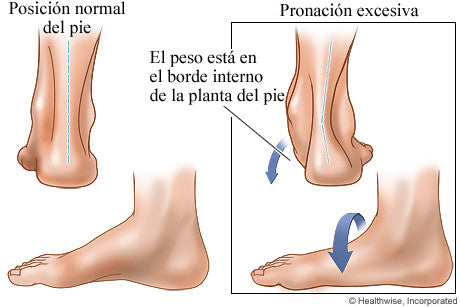 El Mejor Tratamiento Para La Fascitis Plantar Cronica Terapiadefrio Com