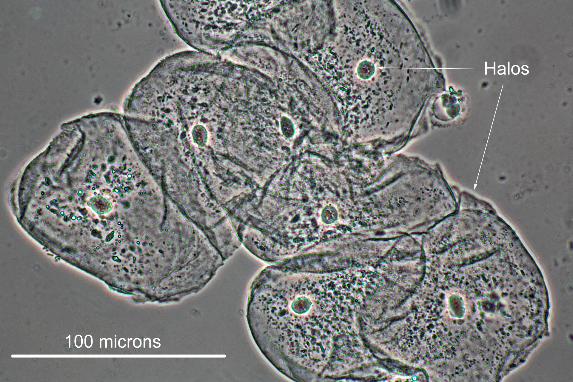 Phase Contrast Microscopy By Motic Motic Microscopes