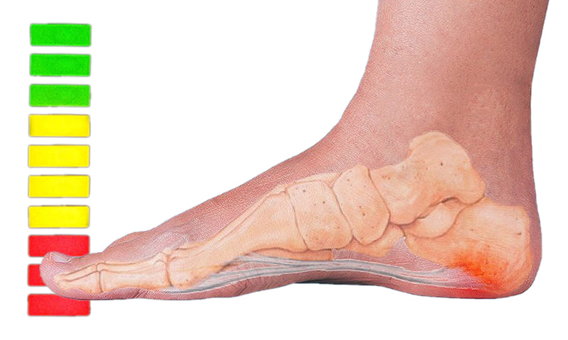 How To Heal Plantar Fasciitis Quickly Effective Heel Pain Treatments Feet Feet