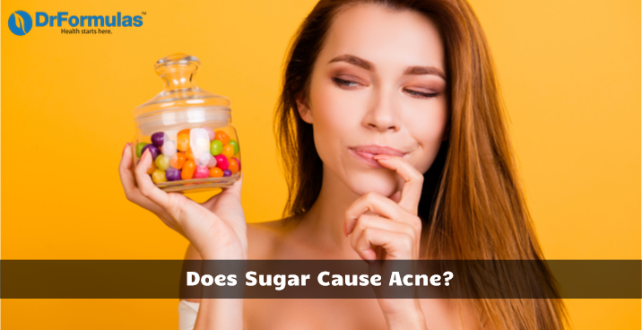 How To Eat Sugar Without Getting Acne Drformulas