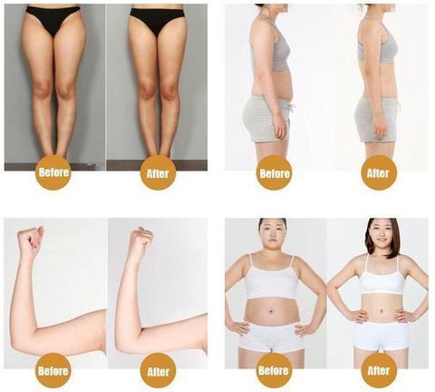 Spatchi Patch Minceur Traditionnel 40 Pieces Coin Bleu