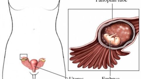كيف يكون الحمل خارج الرحم