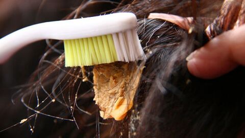 طريقة إزالة اللبان من الشعر