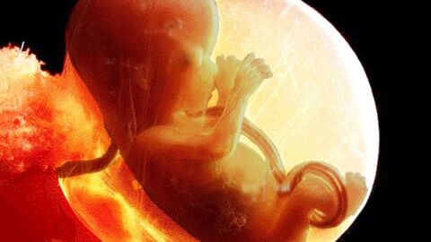 أسباب وفاة الجنين في الشهر التاسع