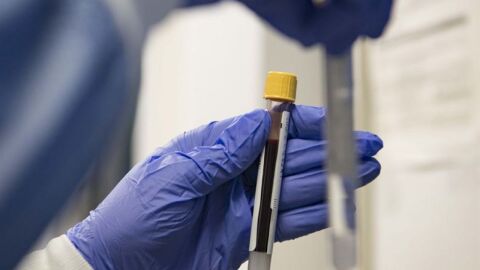 تحليل الدم لمعرفة الحمل
