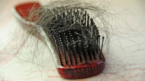 طرق علاج تساقط الشعر للنساء