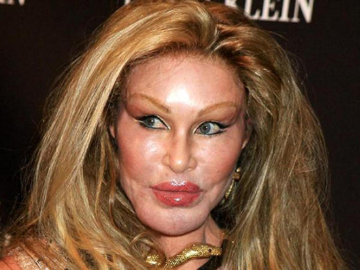Jocelyn Wildenstein Wanita Super Kaya Yang Doyan Permak Wajah Bisnis Liputan6 Com