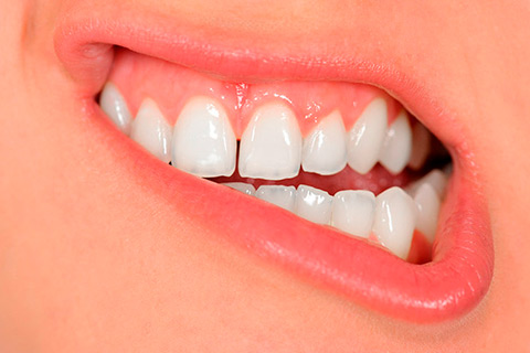 realizar una limpieza dental espacio entre los dientes