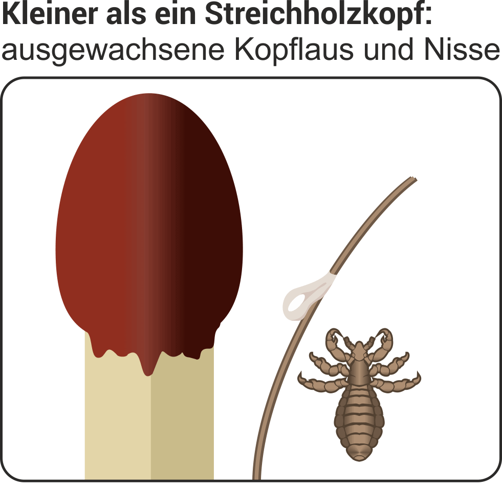 Lause Erkennen Bekampfen Vorbeugen Wolfs Apotheke Bredstedt