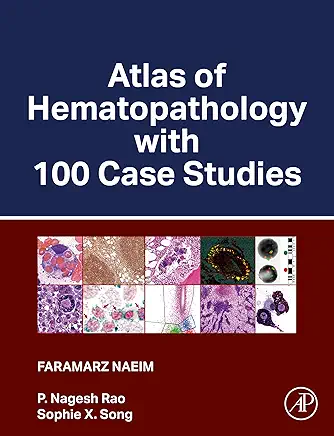 Book cover for 'Atlas of Hematopathology with 100 Case Studies' displayed prominently in larger text