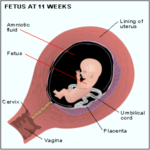 fetus at 11 weeks