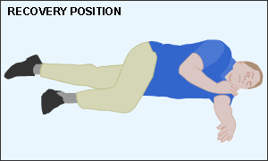 recovery position