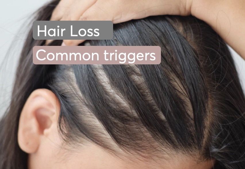 Hair Loss In Women What Are The Triggers Mdhair