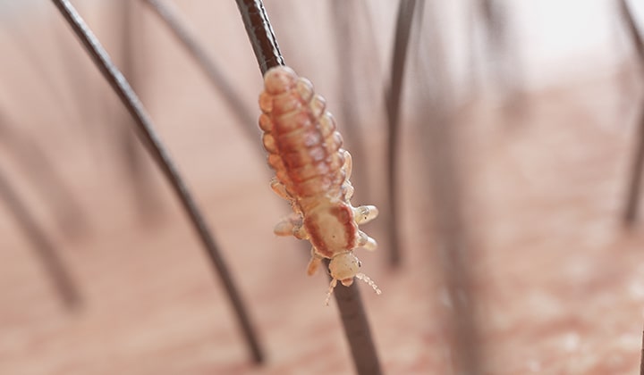 Lause Oder Schuppen Unterschiede Erkennen Terzolin