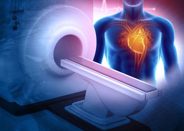 Migrengyogyitas Ibr System Segitsegevel Alkupon Egeszseg