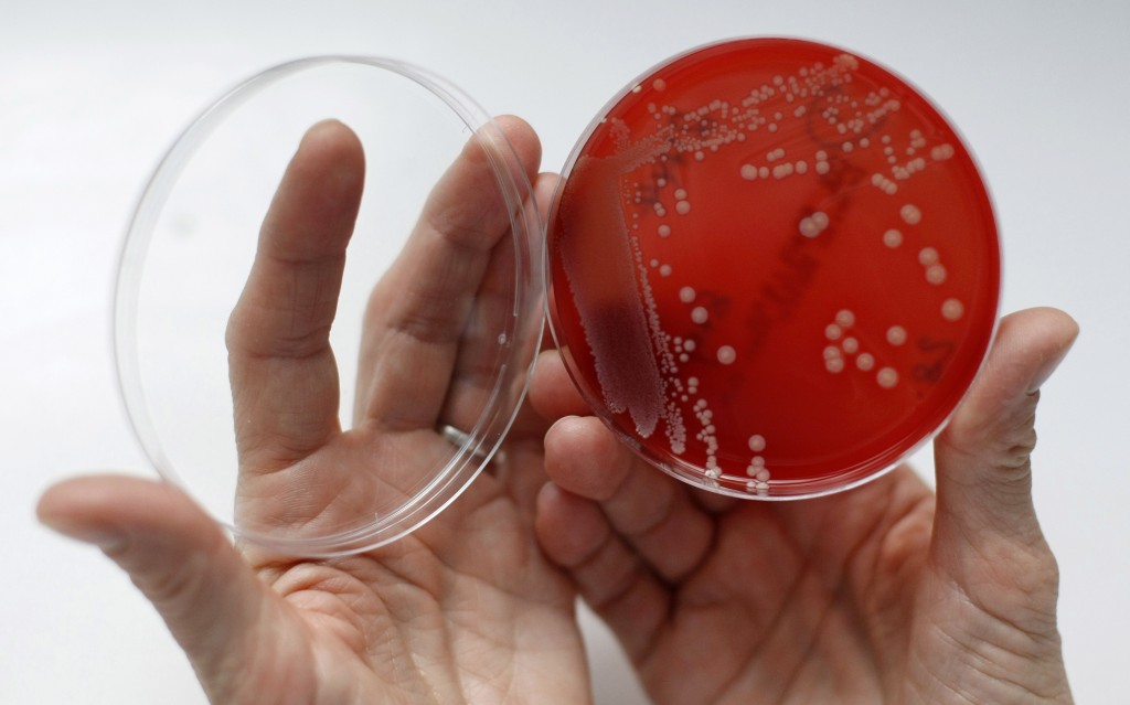 A display of MRSA (Methicillin-resistant Staphylococcus aureus) bacteria strain inside a petri dish containing agar jelly for bacterial culture in a microbiological laboratory in Berlin March 1, 2008. MRSA is a drug-resistant "superbug", which can cause deadly infections. Photo by Fabrizio Bensch/Reuters