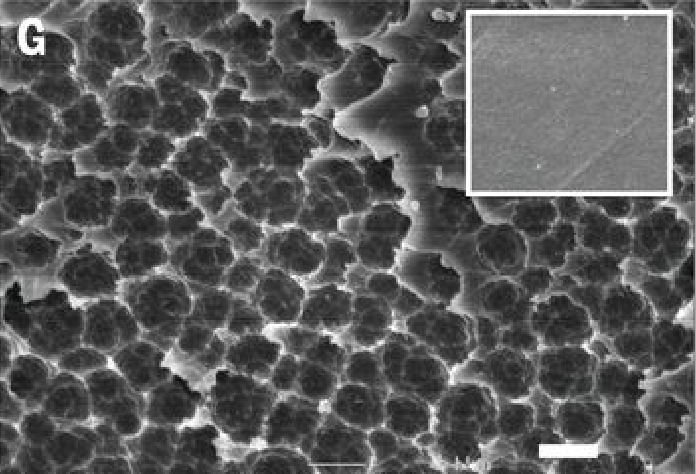 Scanning electron microscopy image of the degraded surface of a piece of PET after 60 hours with Ideonella sakaiensis. The inset shows the original smooth surface of the PET plastic. Scale bar, 1 μm. Photo courtesy of Yoshida et al., Science, (2016). 