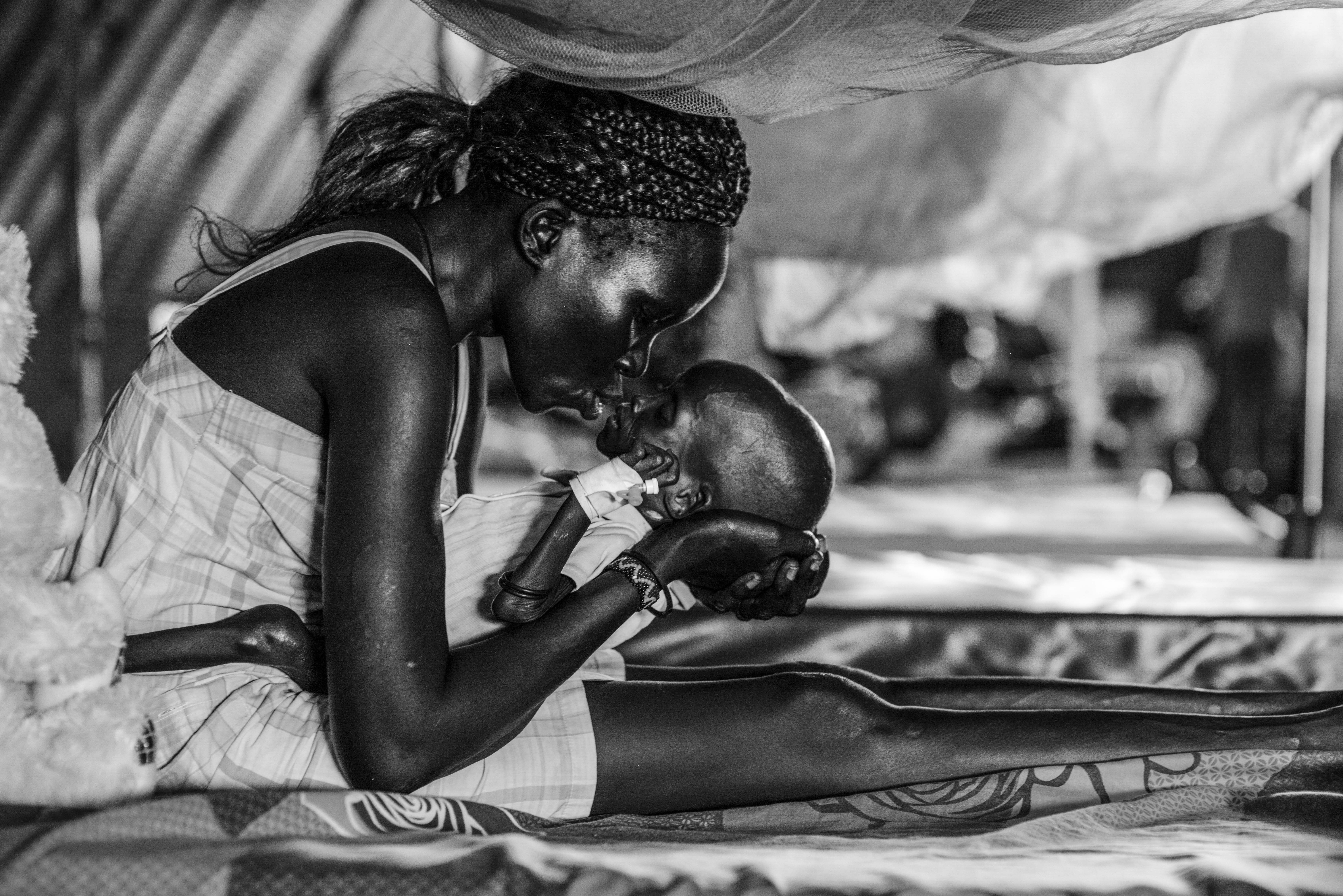 Jal Puok, 1, who suffers from severe acute malnutrition, is embraced by his mother Eliza, 28. Photo by Sebastian Rich for UNICEF