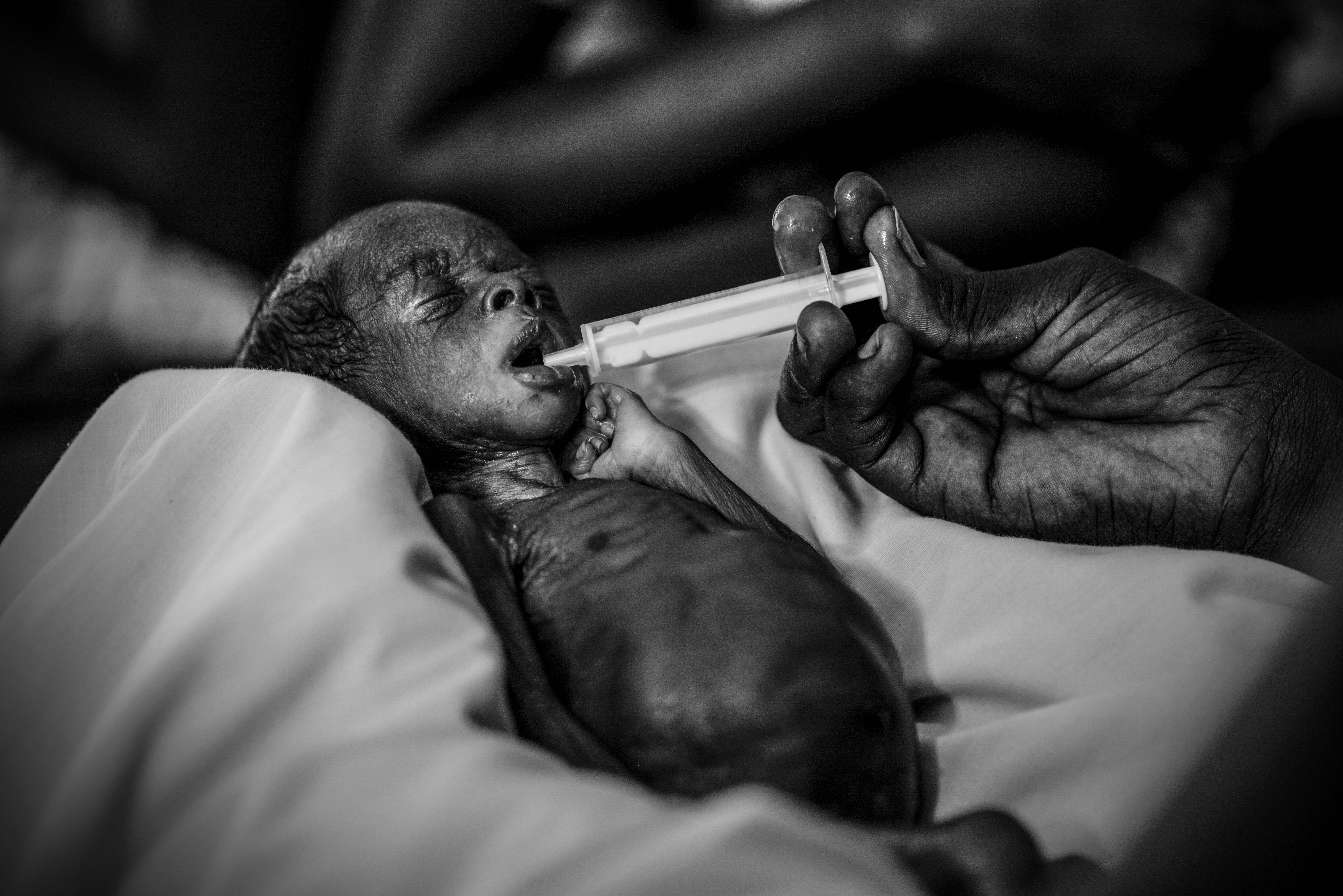 A premature baby is fed baby formula by syringe in a hospital near Juba, South Sudan. Photo by Sebastian Rich for UNICEF