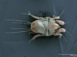 Scanning electron microscope image of the "House Dust Mite". Photo by Gary Bauchan, Ron Ochoa and Chris Pooley/USDA – ARS, Electron & Confocal Microscopy Unit, Beltsville, MD.