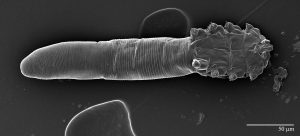 Scanning electron microscope image of the "Simon Mite". Photo by Gary Bauchan, Ron Ochoa and Chris Pooley/USDA – ARS, Electron & Confocal Microscopy Unit, Beltsville, MD.