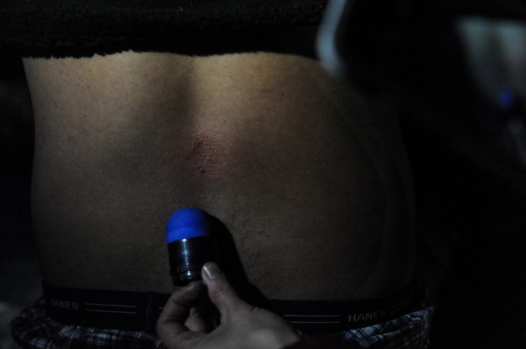 A rubber bullet and a rubber bullet wound are displayed for the camera during a protest against plans to pass the Dakota Access pipeline near the Standing Rock Indian Reservation, near Cannon Ball, North Dakota. Photo by Stephanie Keith/Reuters