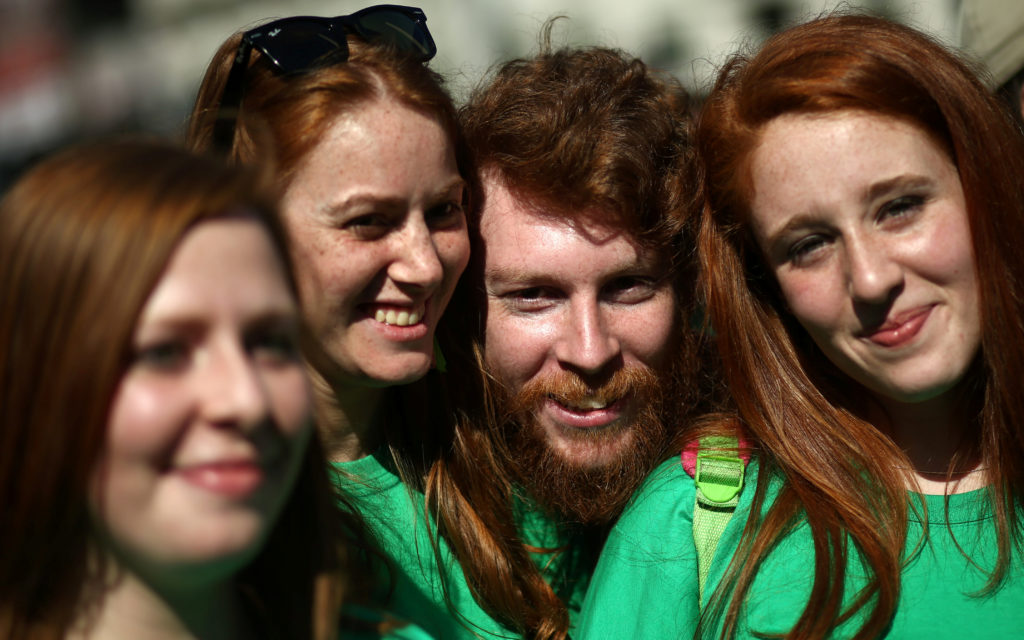 Studies have shown redheads need more anesthesia but fewer opioid painkillers than individuals with other hair colors. Photo by Marcos Brindicci/Reuters