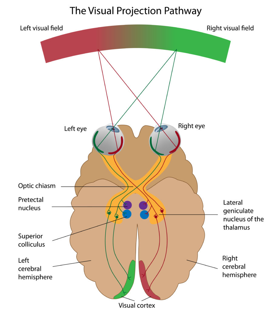 Our eyes work by sending light from the left side of our heads (red) to the right side of the brain, while the right visual field serves the left side of the brain. Optic nerves carry these signals, crossing at point called the optic chiasm. The nerves link to the occipital lobe, which houses the visual cortex, via the lateral geniculate nucleus but also feed the pretectal nucleus and superior colliculus. The latter two help eyes adjust to changing light levels and direct eye movement, respectively. Because Tanner’s right occipital lobe is gone, signals from the left visual field (red) are not processed by his brain. Image by Alila Medical Media/via Adobe Stock