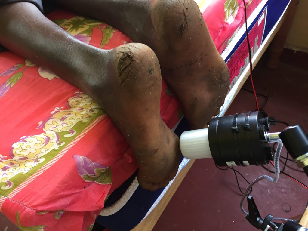 The custom-built device that researchers could use in the field to test a person's sense of touch on the bottoms of their feet. Image by Daniel Lieberman