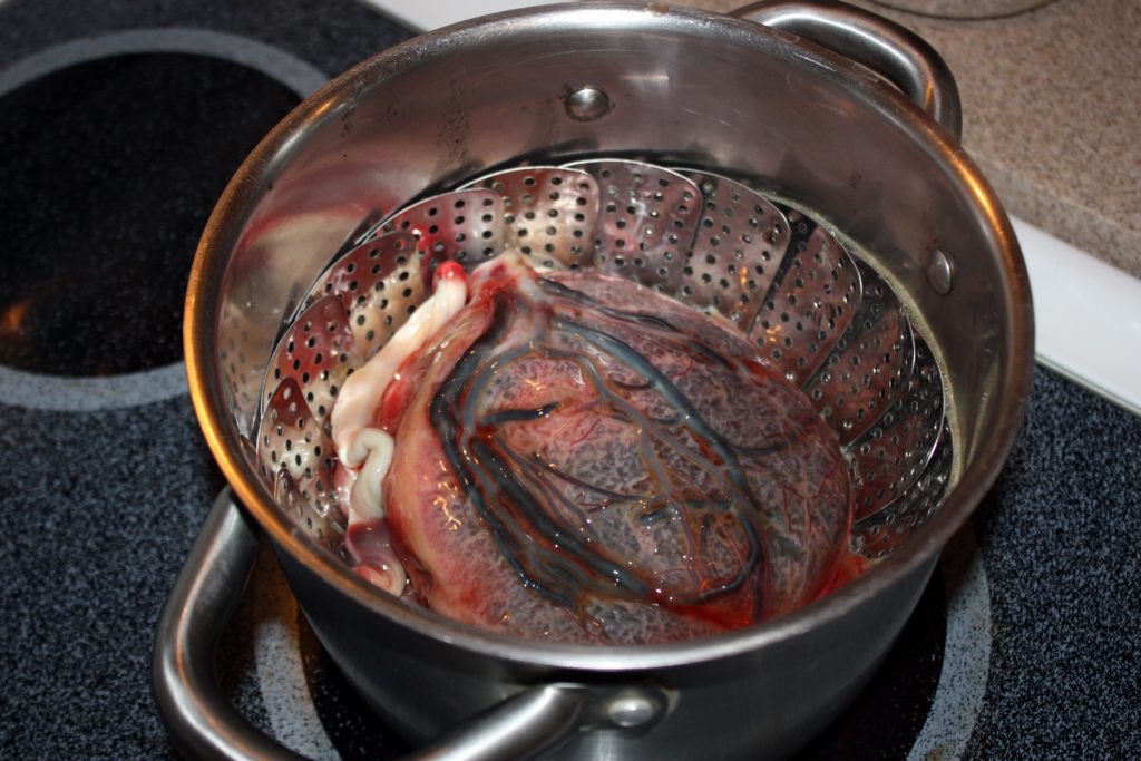 A human placenta and umbilical cord are steamed prior to dehydration February 9, 2015, in Washington, DC. The placenta is dehydrated and ground to a powder which is then put into a pill capsule for a new mother to consume, hoping to increase their milk production or reduce the postpartum depression. Photo by Raphaelle Picard/AFP/Getty Images