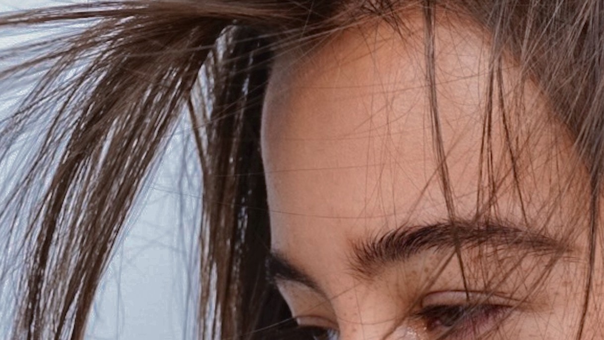Smelly Scalp Why Does It Happen And How Can You Fix It