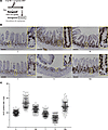 IFN-γ modulation of ileal crypt cell proliferation in response to irradiati