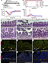 IFN-γ increases the radiosensitivity of intestinal epithelial tissue.