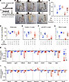 Aggravated radiation enteropathy and impaired epithelial regeneration induc