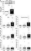 NOTCH3 signaling in mutant TgNotch3R169C mice.