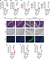 Pancreas-specific cKO of Pfkfb3 protects mice from the FAEE-induced damage.