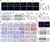 Knockdown of CNN2 attenuates tubular cell death and kidney inflammation in