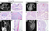 MRI and histological comparison of tumors exposed to 150 kHz TTFields versu