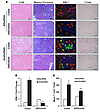 Rescue of DRD2 expression minimizes the renal injury induced by Drd2 silenc