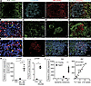 Fibroblasts with distinct phenotypes underlie tertiary lymphoid tissue (TLT