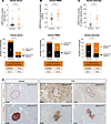 HERV-W-Env is expressed in human T1D patients.