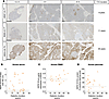 Characteristics of HERV-W-Env expression in pancreas and during the course