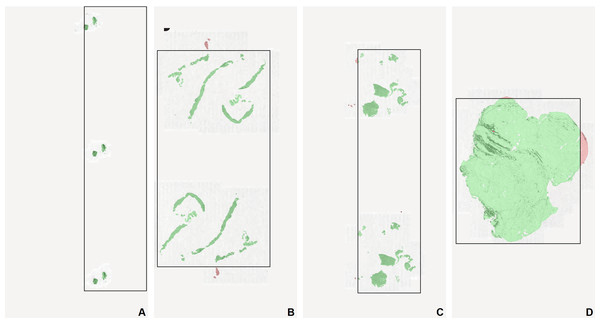 Examples of failed tissue detections by a whole-slide scanner.