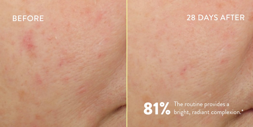Can Coconut Oil Clog Your Pores Proven