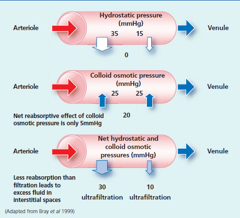 Oedema Causes Physiology And Nursing Management